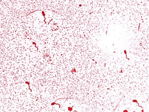 VI KHUẨN VIBRIO – TÌM HIỂU CHÚNG ĐỂ NUÔI TÔM THÀNH CÔNG